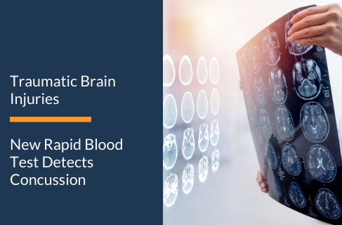 New Rapid Blood Test Detects Concussion / Traumatic Brain Injuries